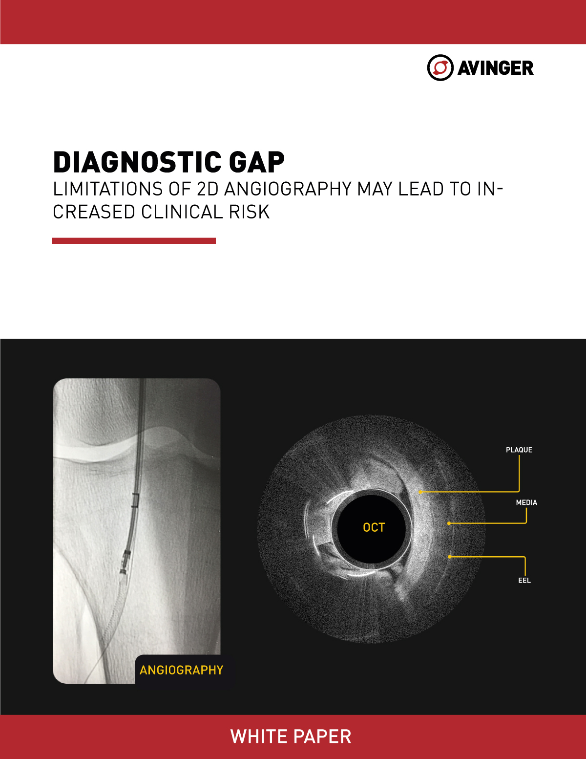 white-paper-thumbnail-Diagnostic-gap