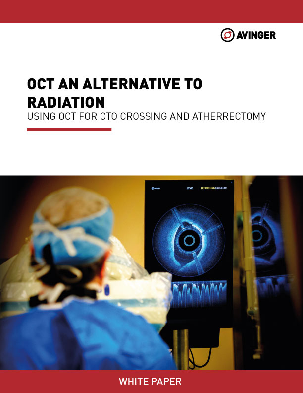white-paper-thumbnail-OCT-an-Alternative-to-radiation